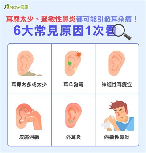 耳朵癢|耳朵癢是耳屎太多？6大原因、4招緩解 專家1次告訴。